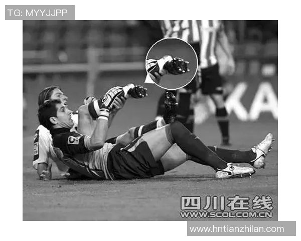 中国足球断腿球星背后悲剧与坚持的故事探秘 中国足球断腿球星背后悲剧与坚持的故事探秘